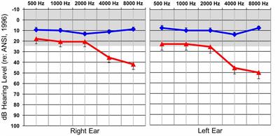 Somatosensory Cross-Modal Reorganization in Adults With Age-Related, Early-Stage Hearing Loss